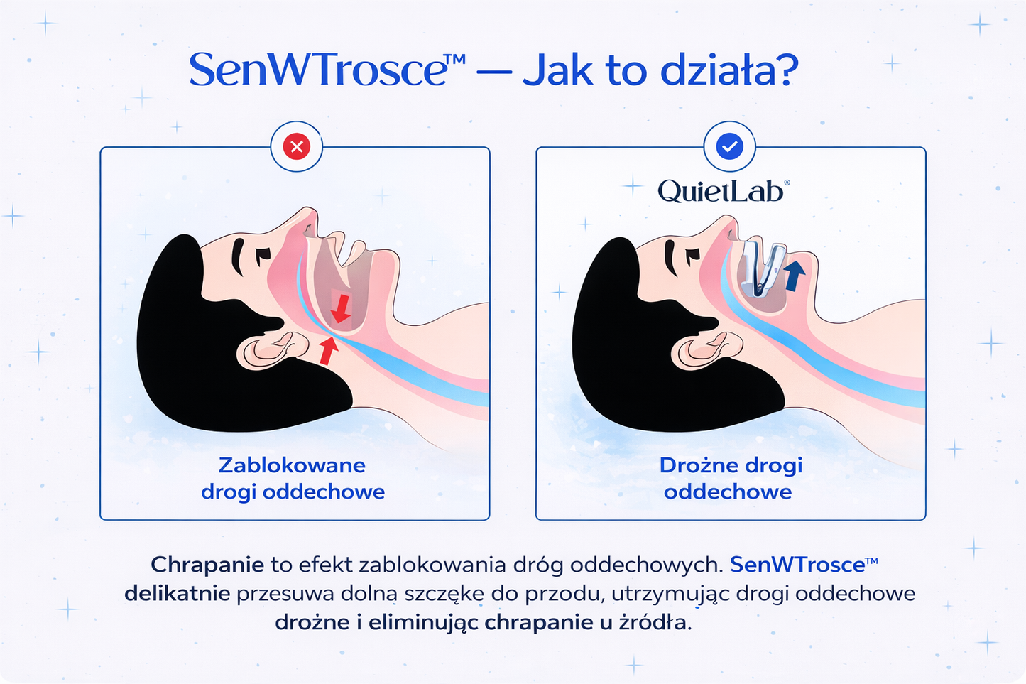 Ustnik Przeciw Chrapaniu SenWTrosce